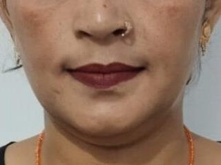 Chhaya hot
