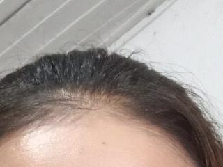 Ntpham