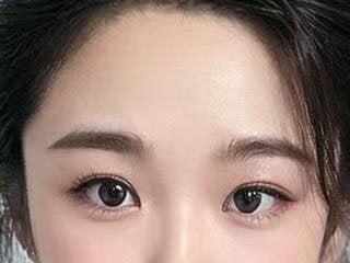 Summer-yi